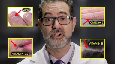 "You May Not Be Healthy Even If You Think You Are" (9 signs)