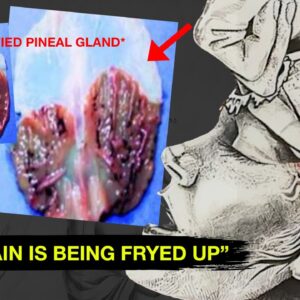 ""Your Third Eye is Being Blocked"